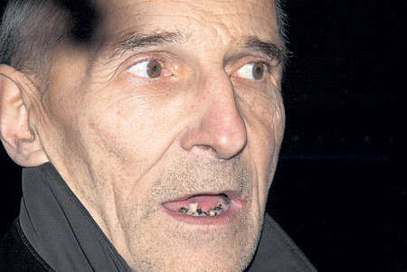 Петр МАМОНОВ уже много лет страдает серьёзной болезнью зубов