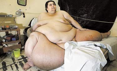 Мексиканец весом 560 кг признан самым толстым в мире