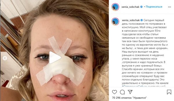 Ксения Собчак сломала нос - или ей кто-то помог?