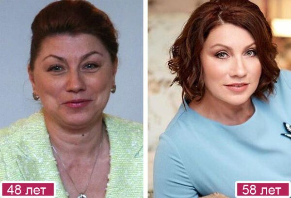 Роза Сябитова до и после пластики. Фото Инстаграм