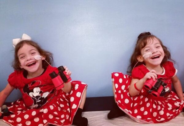 Как выглядят после разделения сиамские близнецы Эрика и Ева Сандовал, которые родились с общим телом ниже груди