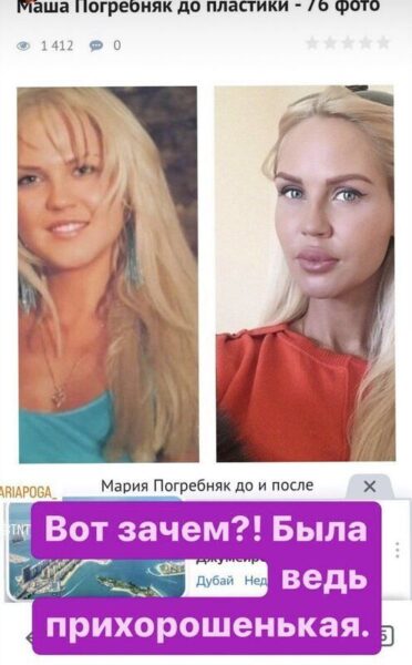 Євелина Бледанс разместила фото Погркбняк до и после пластики