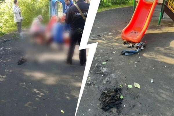 Мальчика подожгли на детской площадке