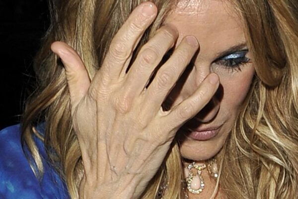 10 фото знаменитостей с проблемными руками, от которых дрожь берет