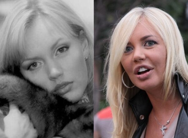 Мария Малиновская до и после пластики