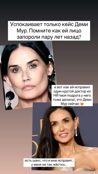 Рита Дакота после неудачной пластики сравнила себя с Деми Мур