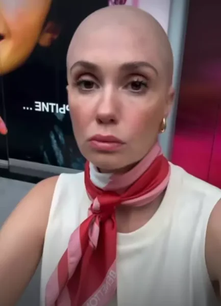 Агата Муцениеце побрилась налысо из-за сожженных волос