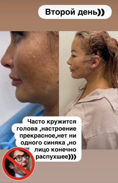 Дана Борисова вновь легла под нож хирурга - фото