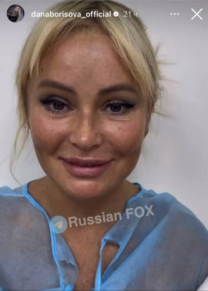Дана Борисова вновь легла под нож хирурга - фото