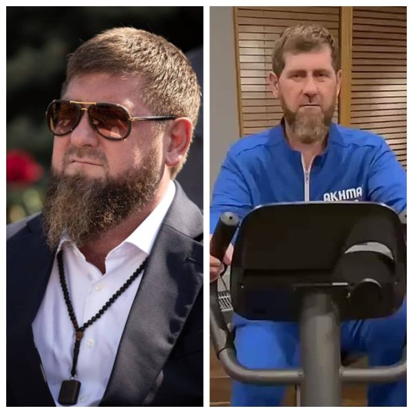 Смертельная болезнь и ложь: что на самом деле происходит с резко похудевшим Кадыровым