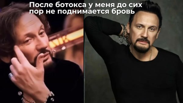 «Бровь до сих пор не поднимается»: Стас Михайлов откровенно рассказал о неудачном ботоксе