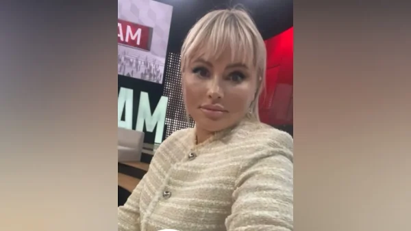 "Это неудачный ракурс", - Дана Борисова оправдалась за пугающий после пластики вид
