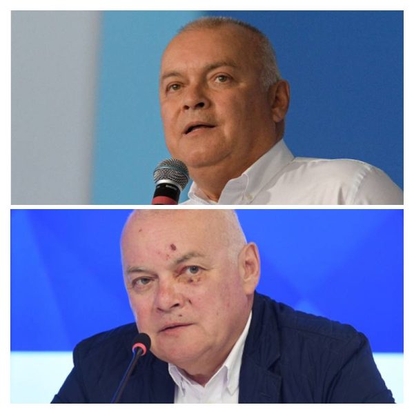 Дмитрий Киселев: что на самом деле скрывается за диагнозом телеведущего