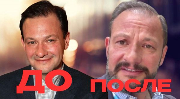 Мне вырезали всю носоглотку: Сергей Брилёв впервые о тяжелой болезни, которая изменила его до неузнаваемости