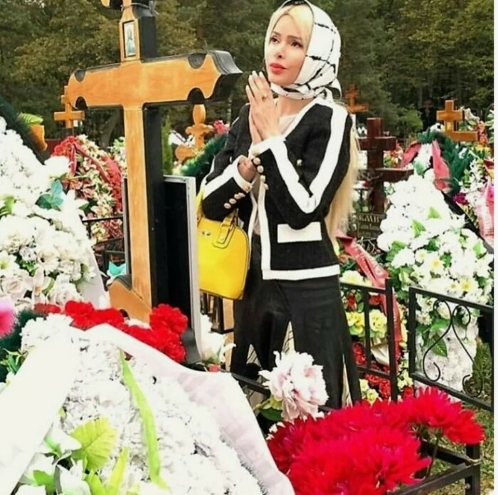 Как Алёна Кравец выглядела до всех пластических операций и без парика