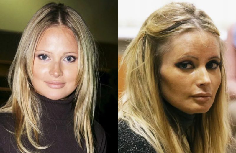 «Обабилась», «мумия» и «жертва солнца»: как годы и привычки изменили некогда блистательных актрис