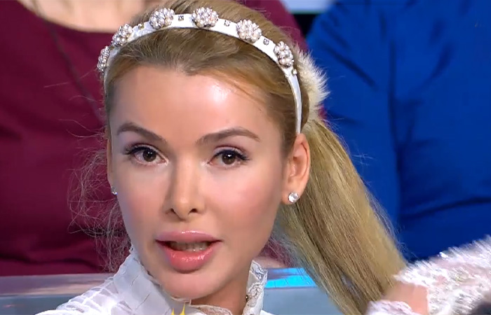 Как Алёна Кравец выглядела до всех пластических операций и без парика