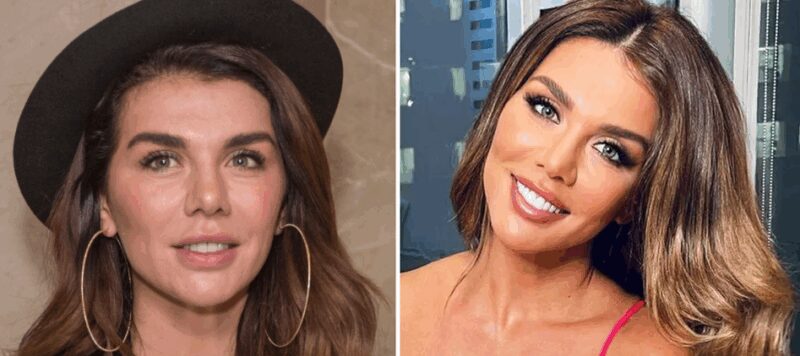 «Пластика ей не помогла!»: как выглядят 6 знаменитостей после преображений и что о них говорят в сети