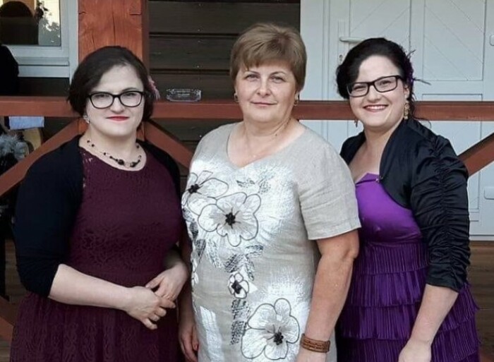 Разделённые судьбы: шокирующая история близнецов, сросшихся головами