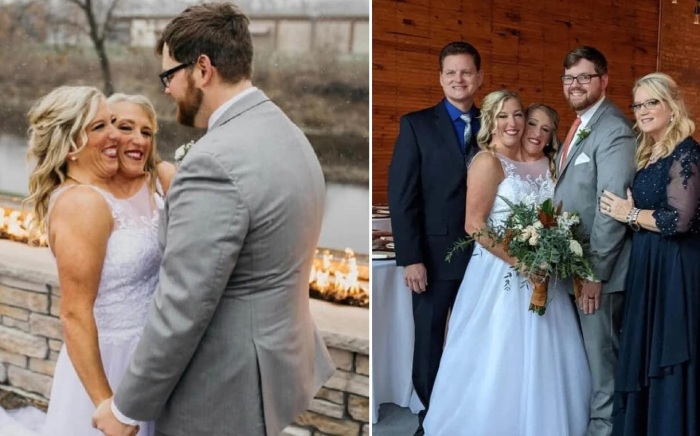 Сиамские близняшки, разделённые одним телом, вышли замуж. Как живут втроём?