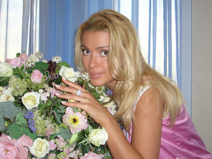 Как Алёна Кравец выглядела до всех пластических операций и без парика