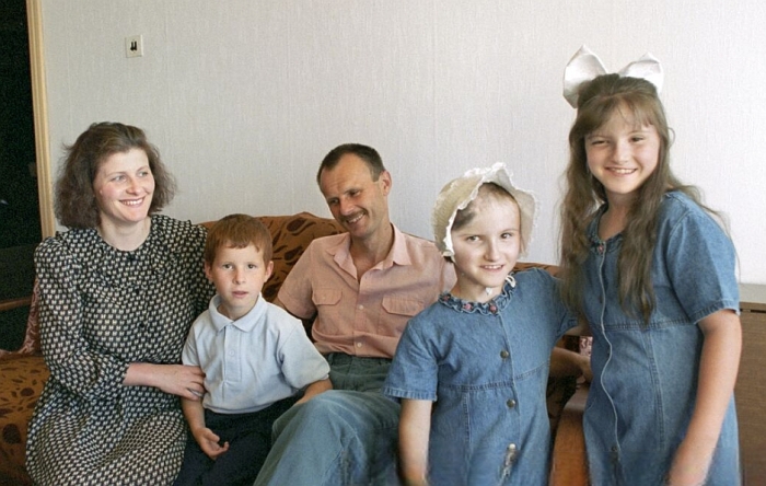 Разделённые судьбы: шокирующая история близнецов, сросшихся головами