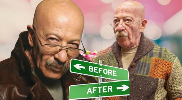 Опухоль мозга у Розенбаума: правда о секретной операции