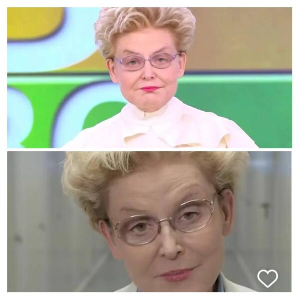 Рак и удаленная почка Малышевой: скрытая болезнь главного теледоктора