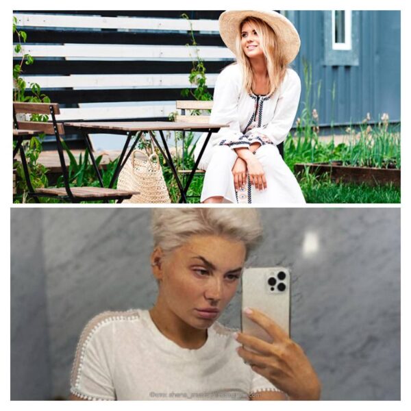 Анна Шульгина потеряла слух после абьюза и впала в депрессию