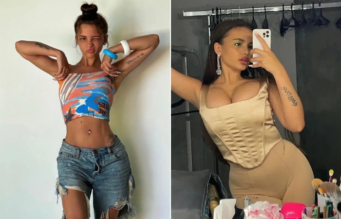 Валя Карнавал до и после пластики.