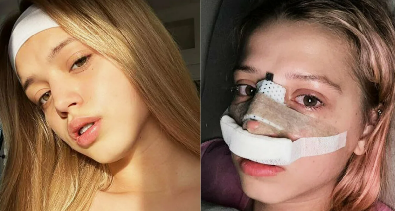 «50 лет — это только начало!»: как Татьяна Навка поразила публику, пока другие звёзды переделывают носы