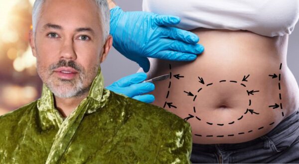 Мне изуродовали тело: вся правда о неудачной пластике Александра Рогова