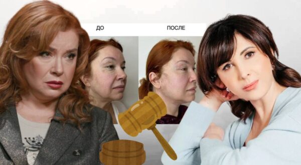 Вера Сотникова - Косметолог изуродовала лицо на миллион