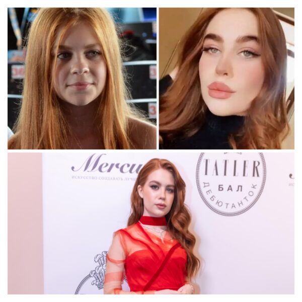 Дети Газманова — Марианна и «новое лицо»: пластика в 18–19 и война с хейтом