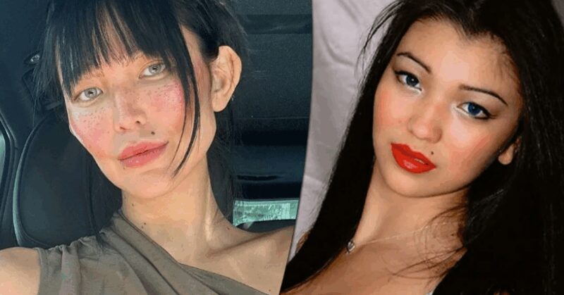 Сравнение внешности Дарины Эрвин до и после пластики.