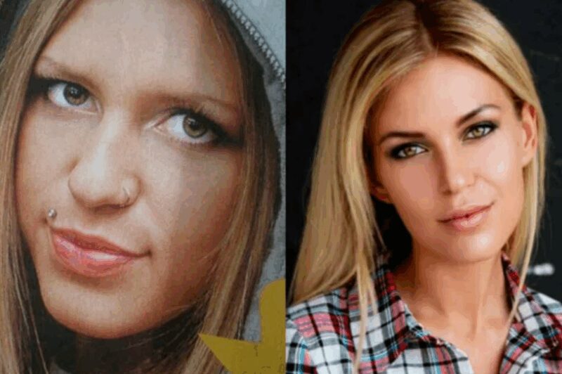 Рита Дакота до и после коррекции носа.