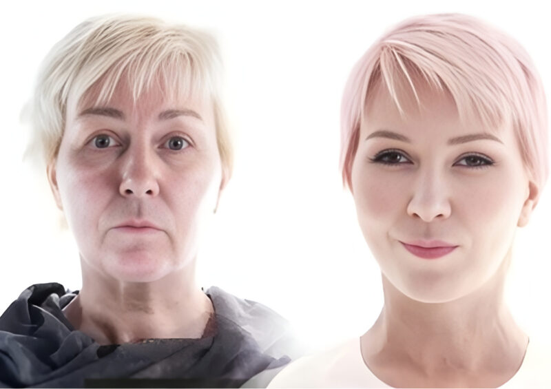 «Зубы словно мешают ей говорить»: как выглядит Ксения Стриж спустя 9 лет после «омоложения» к 50-летию с мужем, моложе на 16 лет