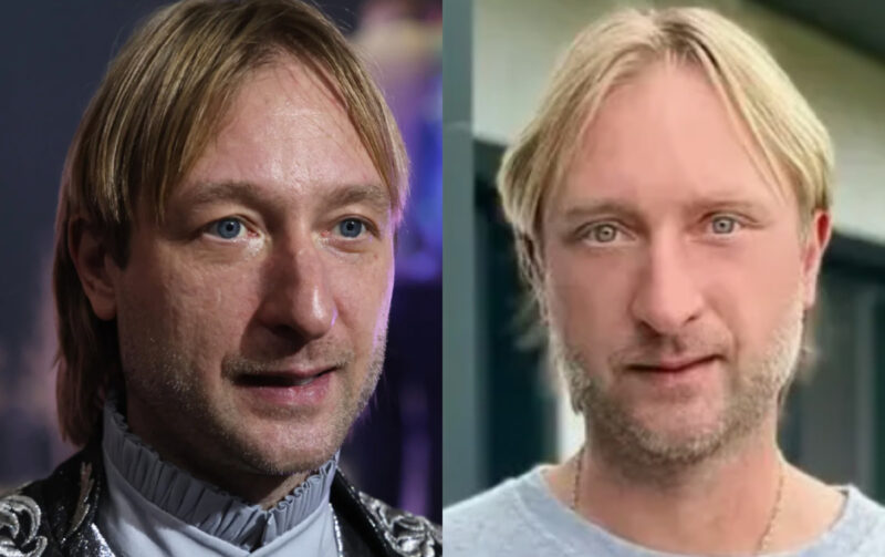 Евгений Плющенко: результаты пластической хирургии.