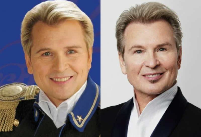 Александр Малинин: возрастные изменения и их коррекция.