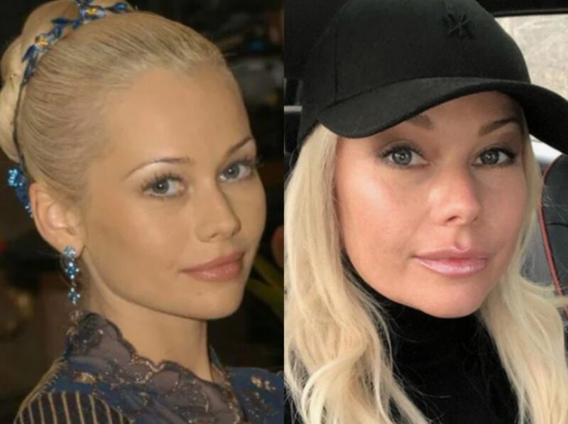 Елена Корикова: до и после пластики, вызвавшей неоднозначную реакцию.