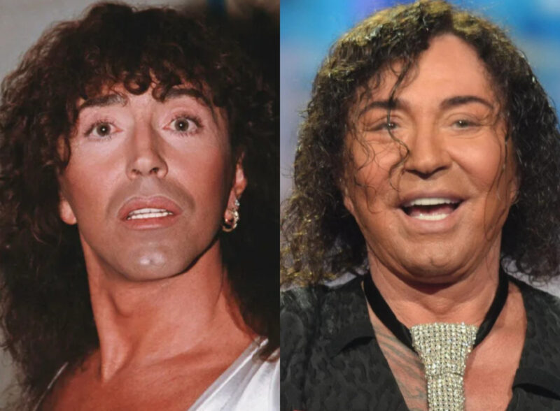 Валерий Леонтьев до и после многочисленных операций.