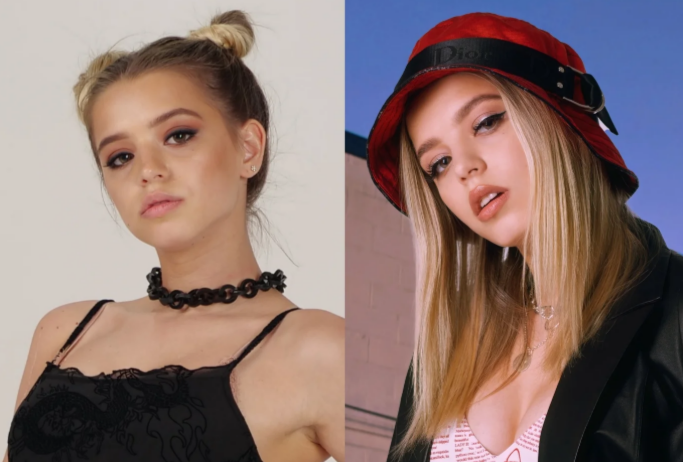 Юлия Гаврилина до и после двух ринопластик.