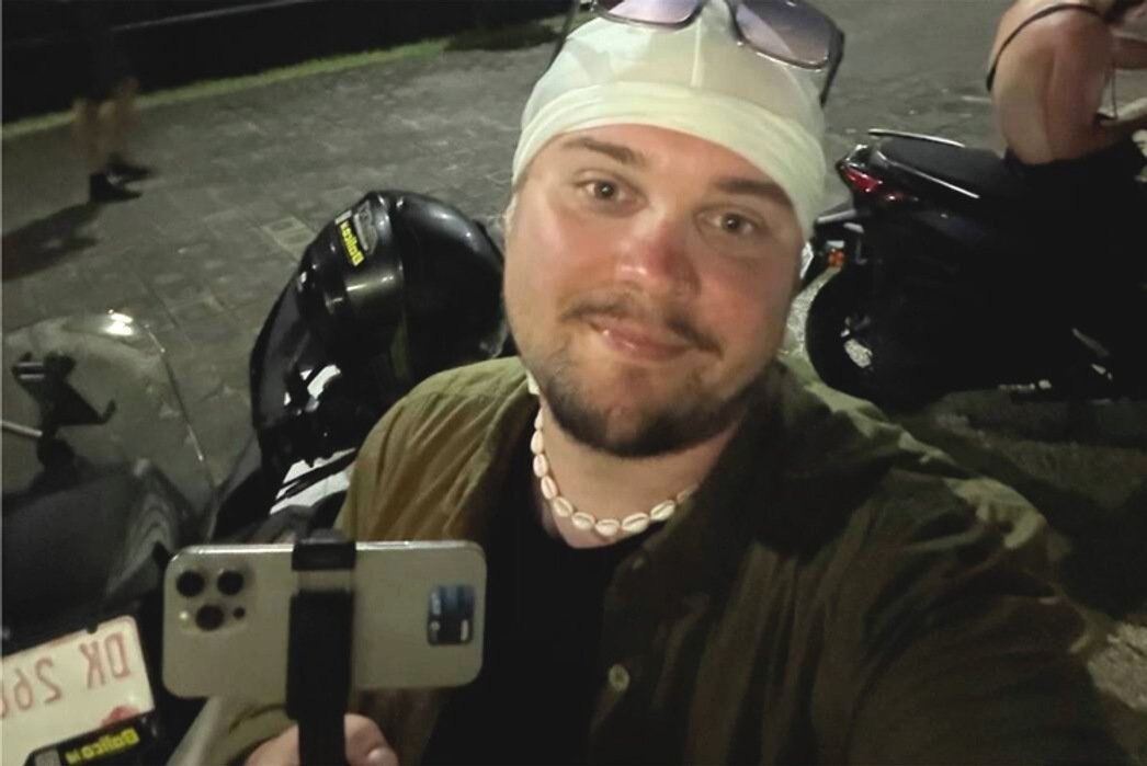 «Нога у меня стала синяя»: блогер Марк Григорьев травмировался на Бали