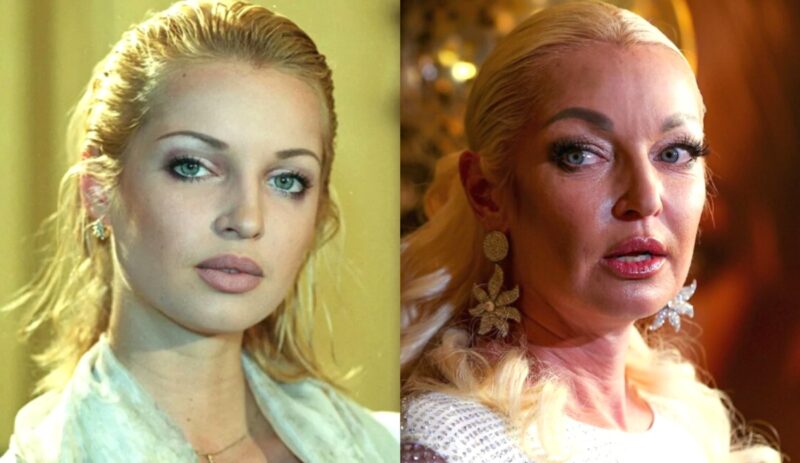 Анастасия Волочкова: как изменилась балерина с годами.