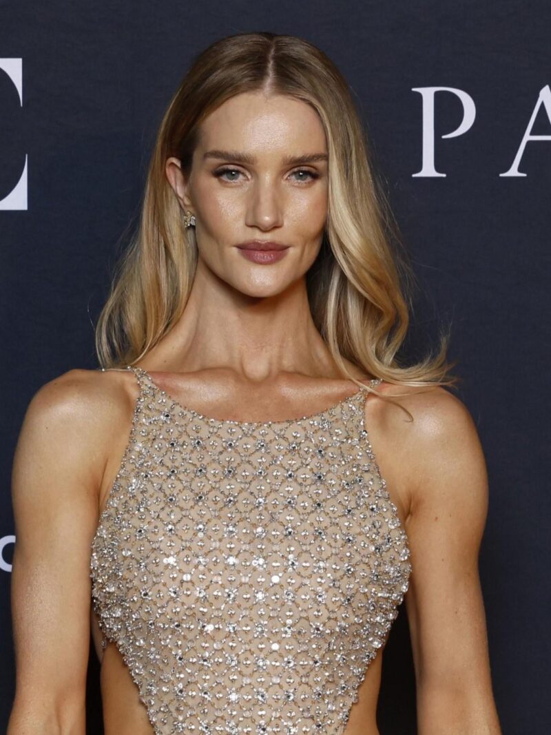 Лицо изменилось до неузнаваемости: что случилось с Роузи?