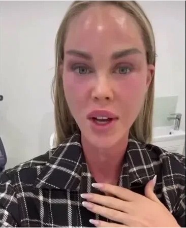 Мария Погребняк уверяет, что не делала пластику.