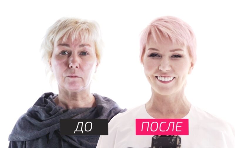 Консультация с пластическим хирургом, определяющим план будущих изменений.