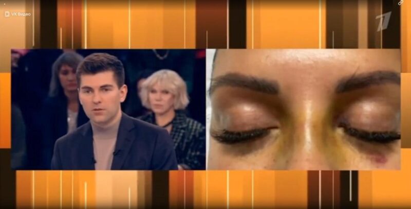 50 миллиардов и побои: самый скандальный развод десятилетия?