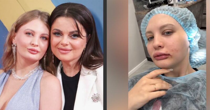 «Очень больно и сложно»: как 23-летняя невестка Наташи Королевой, бывшая стриптизерша, изменилась после пластики за 10 миллионов и чем теперь занимается