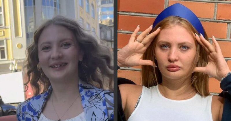 «Очень больно и сложно»: как 23-летняя невестка Наташи Королевой, бывшая стриптизерша, изменилась после пластики за 10 миллионов и чем теперь занимается